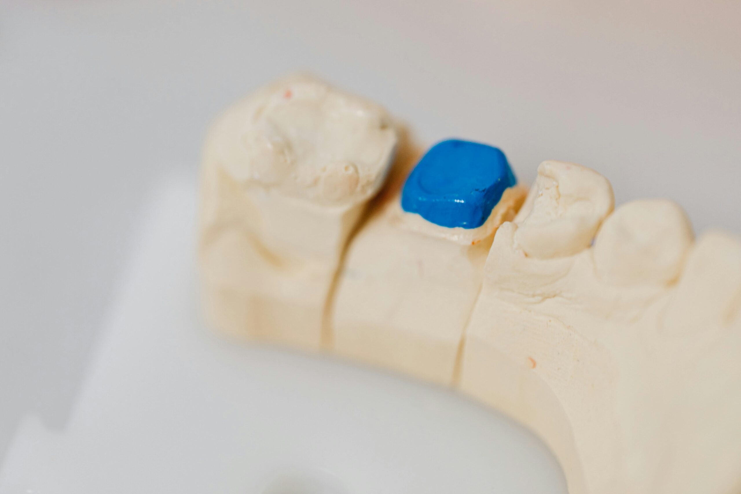 Close-up of a dental jaw model with a blue filling, showcasing dental anatomy and dentistry tools.