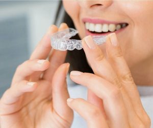 Close-up of a woman holding a clear dental aligner, showcasing dental health and a bright smile.