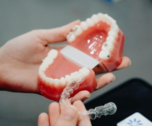 Invisalign A close-up of hands holding a dental mold and clear aligner, perfect for orthodontic care visuals.