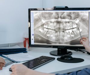 Dentist reviewing a patient's dental x-ray on a computer screen in a clinic.