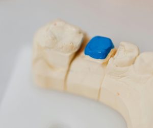 pexels-photo-6627594-6627594 Close-up of a dental jaw model with a blue filling, showcasing dental anatomy and dentistry tools.