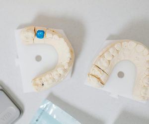 pexels-photo-6627601-6627601 Close-up of dental molds on a white table, showcasing orthodontic details.